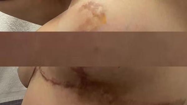 PACIENTE DENUNCIA CIRURGIÃO PLÁSTICO POR SUPOSTO ERRO MÉDICO