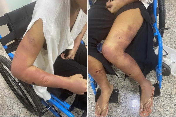 JOVEM DE IBIRÁ É SEQUESTRADA, TORTURADA E MANTIDA EM CÁRCERE PRIVADO PELO NAMORADO EM SÃO JOSÉ DO RIO PRETO; AGRESSOR FOI PRESO